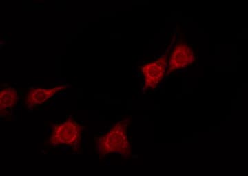 YWHAZ / 14-3-3 Zeta Antibody (phospho-Ser58)