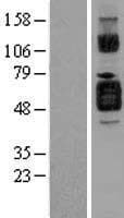 Human CD121b / IL1R2 Protein (Over-Expression Lysate Myc-DDK (Flag))