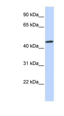 Polyclonal Rabbit anti-Human ZNF239 Antibody (aa108-157, WB)