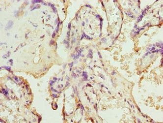 SLC12A4 / KCC1 Antibody