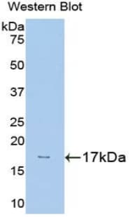 HK1 / Hexokinase 1 Antibody (aa80-215)