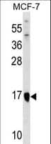 ITGB1BP1 / ICAP1 Antibody (aa108-136)