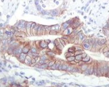 IGF1R / IGF1 Receptor Antibody (clone 3C8B1)