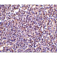 Polyclonal Rabbit anti-Human AIM / CD5L Antibody (IHC, IF, WB)