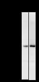 FER Antibody (clone 2358C3a)
