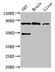 Polyclonal Rabbit anti-Human GARS / Glycyl tRNA Synthetase Antibody (IHC, IF, WB)