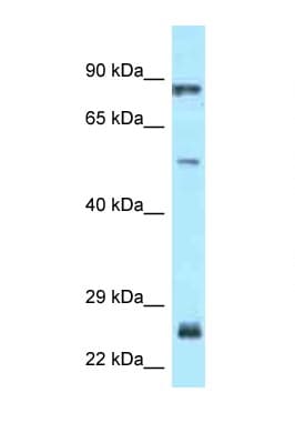 Polyclonal Rabbit anti-Human E2F1 Antibody (aa297-346, WB)