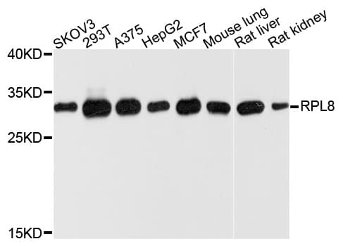 RPL8 / Ribosomal Protein L8 Antibody