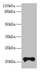 Polyclonal Rabbit anti-Human TMEM154 Antibody (IHC, WB)