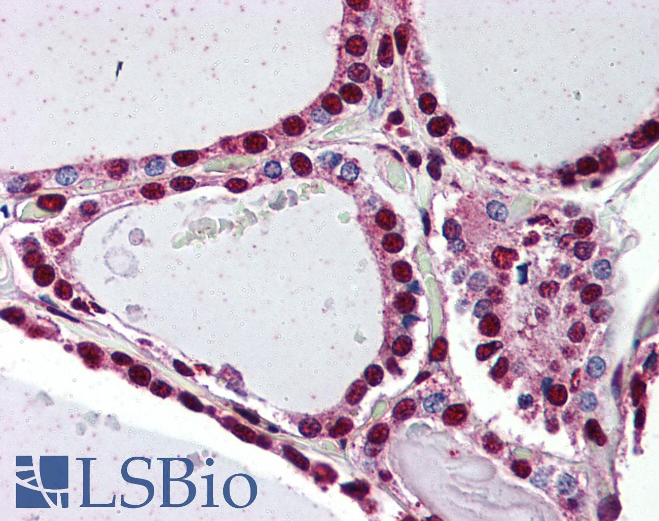IHC-plus™ PROKR2/Prokineticin Receptor 2 Antibody (N-Terminus)