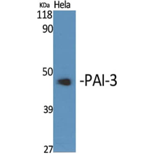 SERPINA5 / PCI Antibody (230-310 aa, Internal)