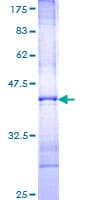 Human FGF14 Protein (Recombinant GST, N-terminus)