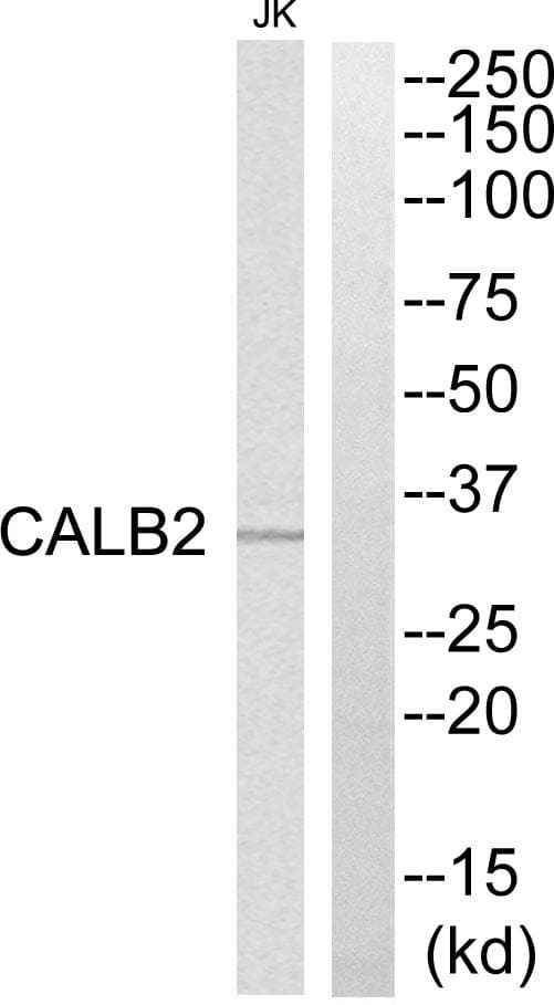 Polyclonal Rabbit anti-Human CALB2 / Calretinin Antibody (WB)