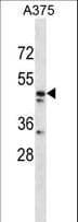 Polyclonal Rabbit anti-Human ZPR1 / ZNF259 Antibody (aa405-434, WB)