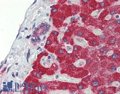 Polyclonal Rabbit anti-Human ADIPOR1/Adiponectin Receptor 1 Antibody (aa1-136, IHC, WB)