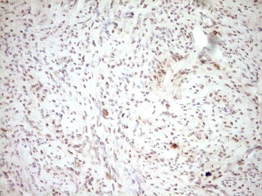 PLAT / TPA Antibody (aa157-426, clone OTI3H3, Carrier-free)