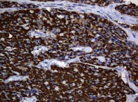 HSPD1 / HSP60 Antibody (clone OTI6F7)