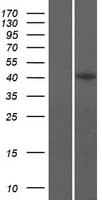 C8orf76 Protein (Over-Expression Lysate Myc-DDK (Flag))