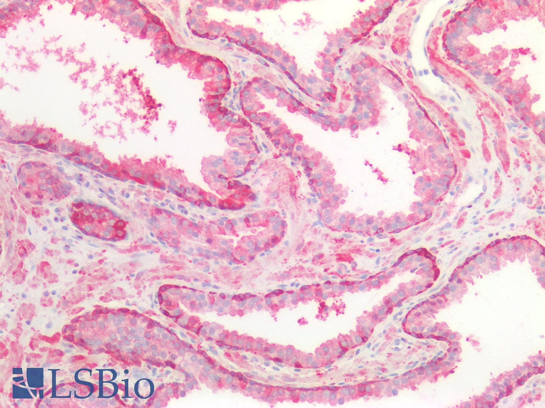 PathPlus™ GPBB / PYGB Antibody