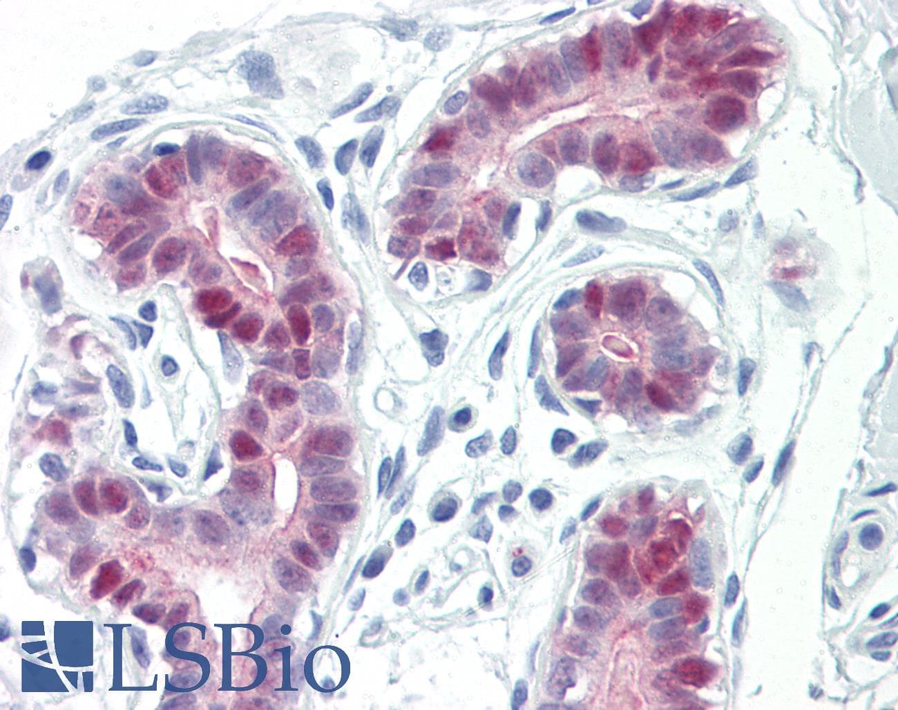 IHC-plus™ MEF2A / MEF2 Antibody (aa296-345)