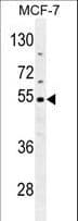 CES2 / Esterase Antibody (aa340-369)