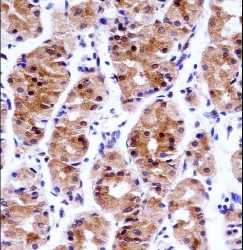GTF2E1 Antibody (aa93-121)