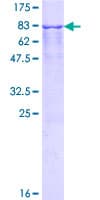 Human TFG Protein (Recombinant GST)