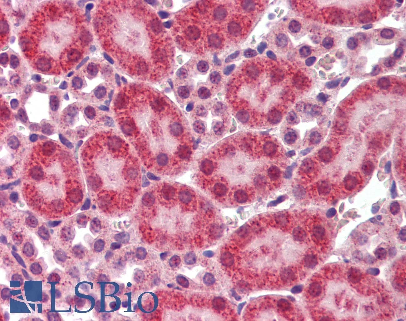 IHC-plus™ Polyclonal Rabbit anti-Human CBLN1 / Cerebellin 1 Antibody (IHC, WB)