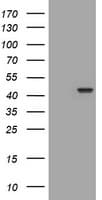 PAX5 Antibody (clone OTI6B6)
