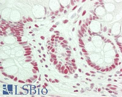 IHC-plus™ Polyclonal Rabbit anti-Human TRIM28 / KAP1 Antibody (aa1-50, IHC, IF)