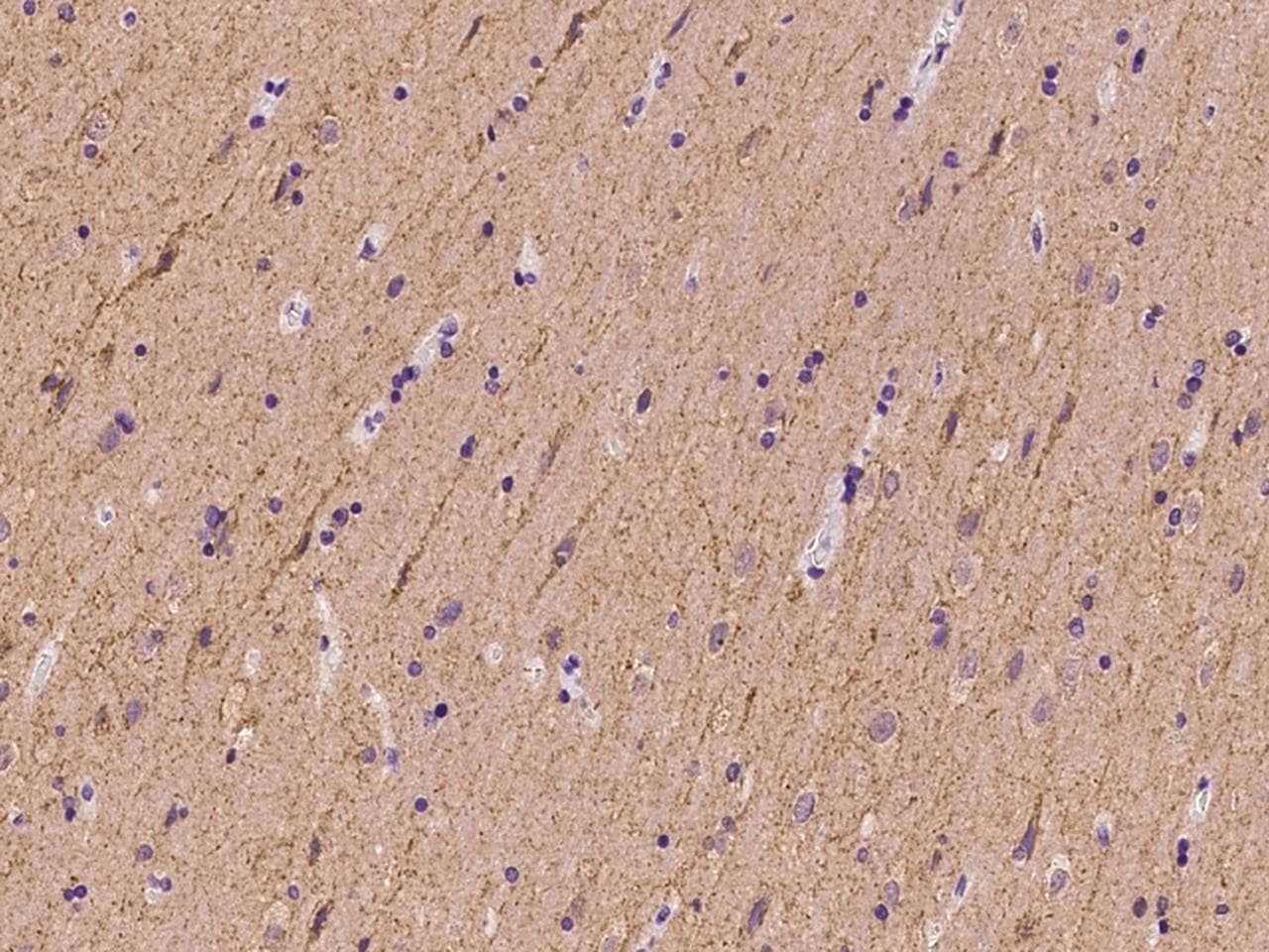 SLC4A10 Antibody