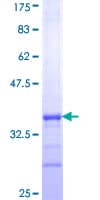 Human USP51 Protein (Recombinant GST, N-terminus)
