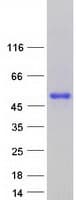 Human HMX3 Protein (Recombinant Myc-DDK (Flag))