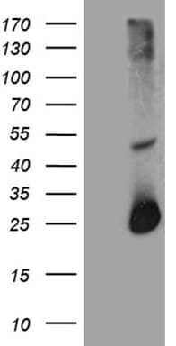 Monoclonal Mouse anti-Human RGS17 / RGSZ2 Antibody (clone OTI8G4, IHC, WB)