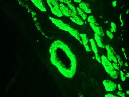 PathPlus™ Smoothelin Antibody (clone R4A)