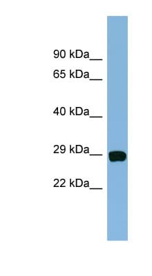 CHCHD3 Antibody (aa35-84)