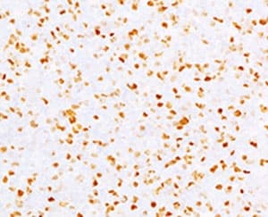 Monoclonal Mouse anti-Human TOP2A / Topoisomerase II Alpha Antibody (clone TPM2A-2, IHC, IF, WB)