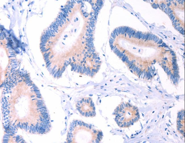 Polyclonal Rabbit anti-Human AADAC Antibody (IHC, WB)