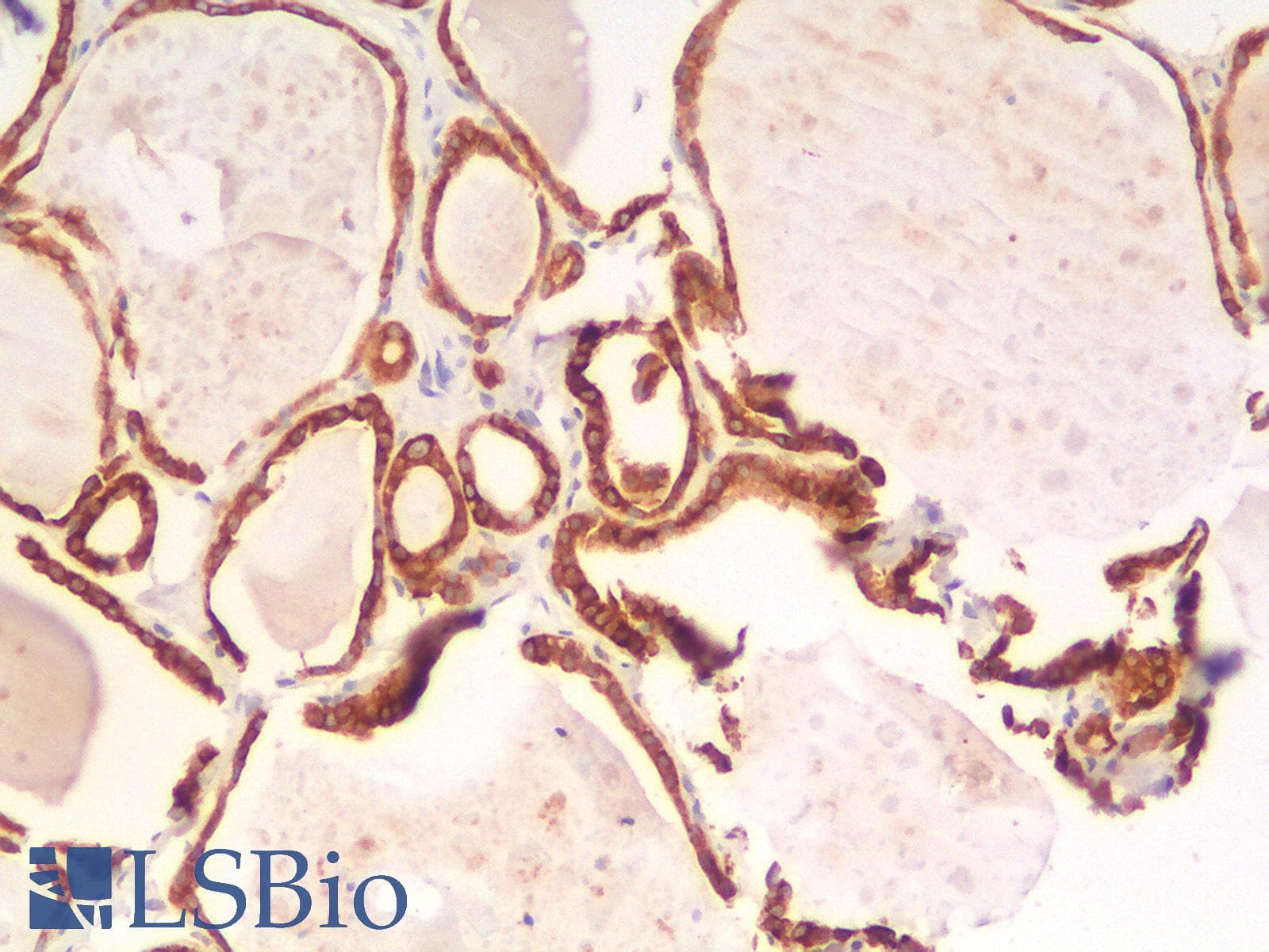 PathPlus™ BCL2 / Bcl-2 Antibody (clone rBCL2/782)