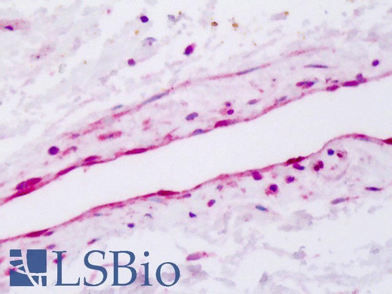 IHC-plus™ FLT1 / VEGFR1 Antibody (aa1251-1338)