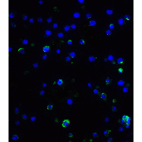 IL17A Antibody