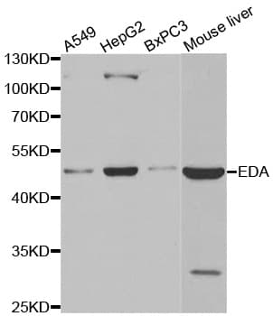 EDA / Ectodysplasin A Antibody