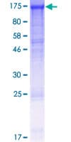 Human DDB1 Protein (Recombinant GST)