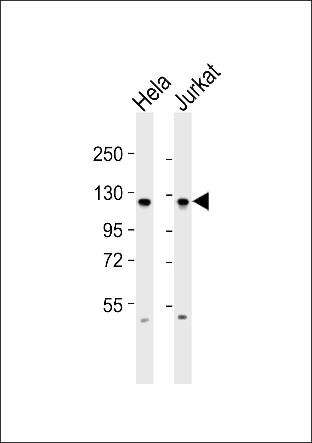 Polyclonal Rabbit anti-Human EFTUD2 Antibody (WB)