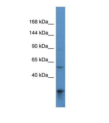 Polyclonal Rabbit anti-Human ACAD10 Antibody (aa306-355, WB)