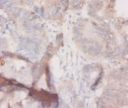 CSF3 / G-CSF Antibody