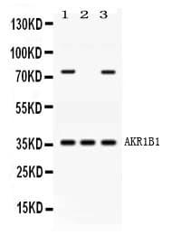 AKR1B1 / Aldose Reductase Antibody