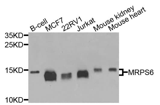 MRPS6 / MRP S6 Antibody
