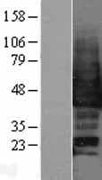 MAPK12 / ERK6 / SAPK3 Protein (Over-Expression Lysate Myc-DDK (Flag))