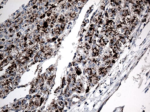 CTSL / Cathepsin L Antibody (aa114-333, clone OTI2C10)
